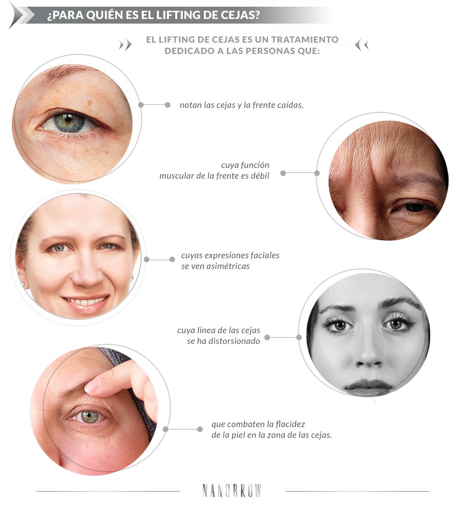 El lifting de cejas es un tratamiento dedicado a las personas que: notan las cejas y la frente caídas, cuya función muscular de la frente es débil, cuyas expresiones faciales se ven asimétricas